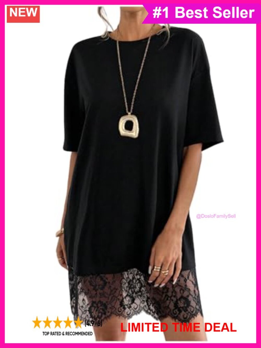 Lace T-Shirt Dress Short Sleeve Loose Casual Above Knee